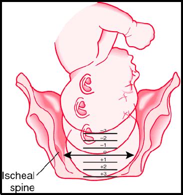 Intrapartum Care Flashcards Quizlet