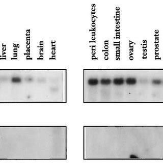 Northern Blot Analysis Of Poly A Rna From Various Human Tissues