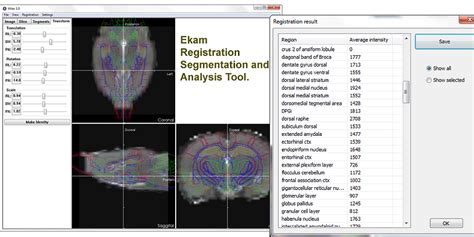 Ekam Solutions Preclinical Image Processing Solutions For Neuro Imaging