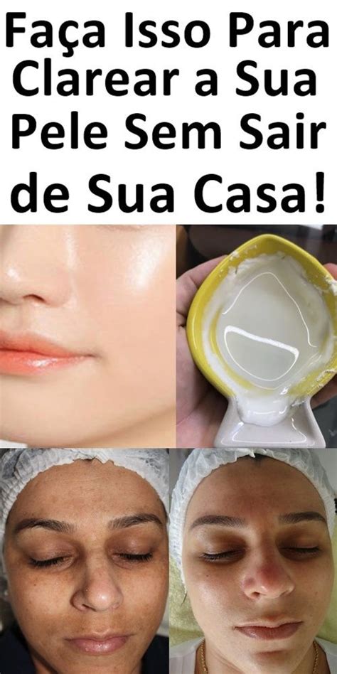 Receita Caseira Para Clarear A Pele Rapidamente Passo A Passo Derm