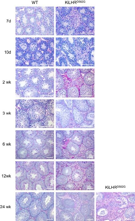 Leydig Cell Hyperplasia In Kilhr D582g Mice Representative Download