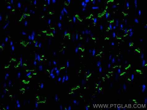 N cadherin antibody 66219 1 Ig Proteintech 武汉三鹰生物技术有限公司