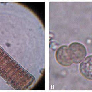 Morphology of cyanobacteria A) Phormidium sp. and B) Synechocystis... | Download Scientific Diagram