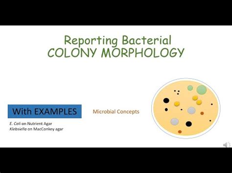 Reporting COLONY MORPHOLOGY Of E Coli And Klebsiella English