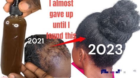 Do Not Use This Prepoo If You Re Not Ready For Extreme Hair Growth