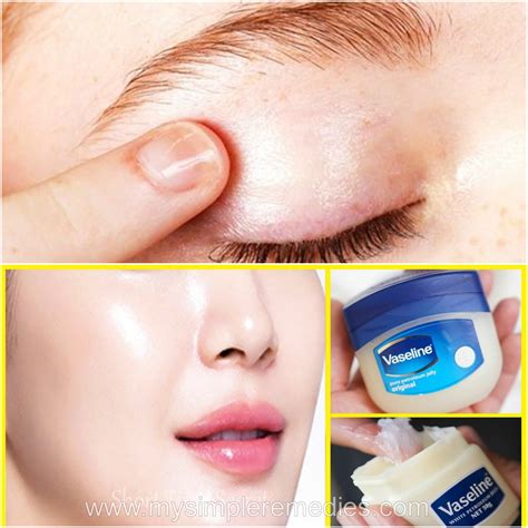 Can I Use Vaseline To Remove Eye Makeup Mugeek Vidalondon