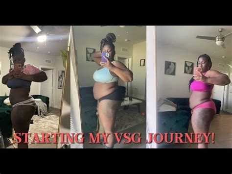 Starting My Gastric Sleeve Journey The Who What When Where And Why