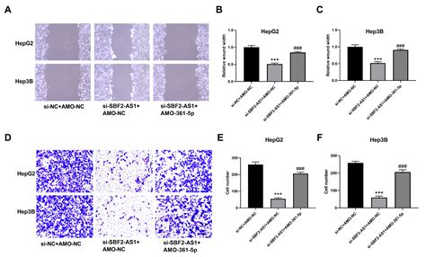 Downregulation Of Lncrna Sbf2 As1 Inhibits Hepatocellular Carcinoma