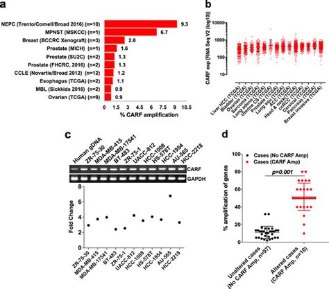 CARF enrichment promotes epithelial mesenchymal transition via Wnt β