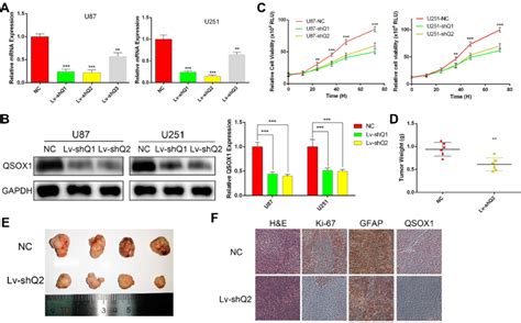 Knockdown Of Qsox Decreased Gbm Cell Growth A The Expression Levels