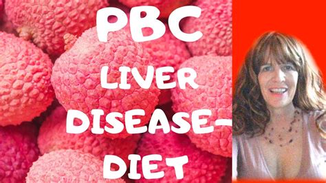 Pbc Living With Primary Biliary Cholangitis A Rare Liver Disease Youtube