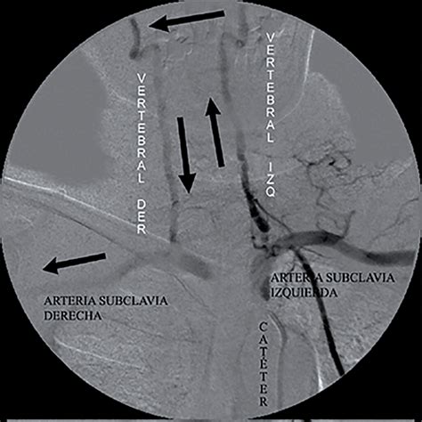 Revista Argentina de Cardioangiología Intervencionista