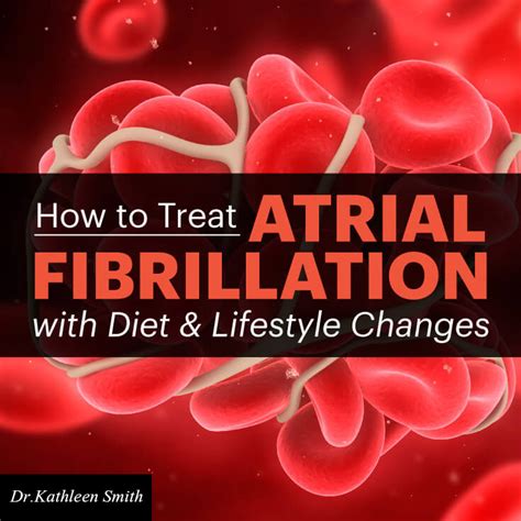 Natural Ways To Treat Atrial Fibrillation