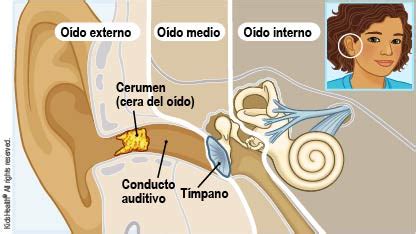 Qué hacer ante la cera de los oídos Rady Children s Hospital