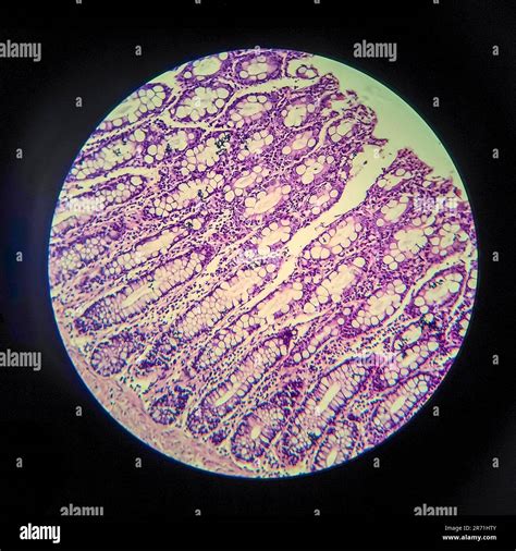 Bacterial Cell Under Light Microscope