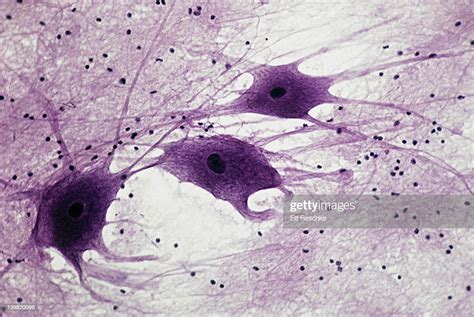 Neurons And Neuroglial Cells Foto De Stock Getty Images