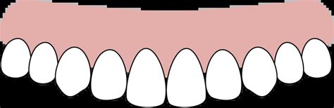 Classification Of Bruxism Teeth Grinding Severity Scale And Diagnosis Guide