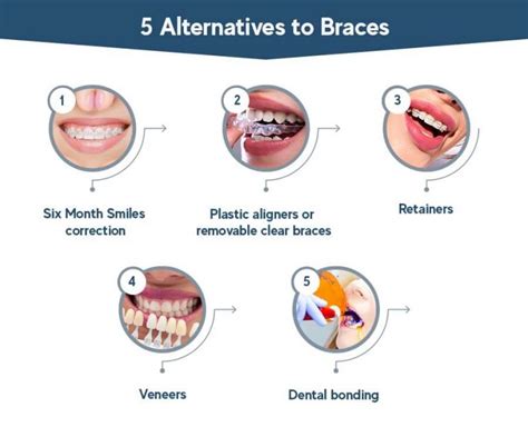 Alternatives To Braces Aligners Accelerated Orthodontics Veneers