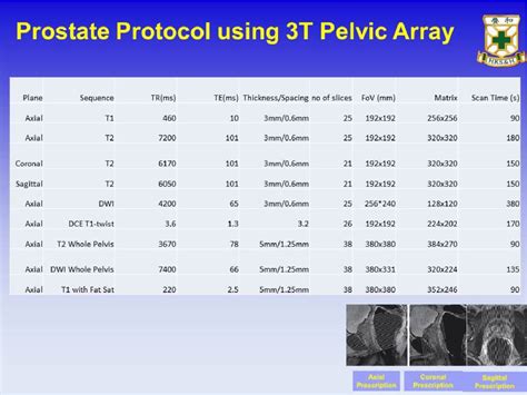 Figure 7 From Multi Parametric Mri Mp Mri In Prostate Experience And