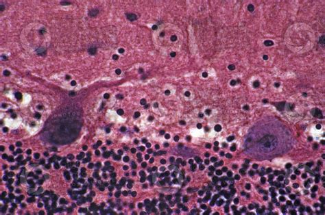 Mammal Cerebellum Sagittal Section 500X Cerebellum Mammals