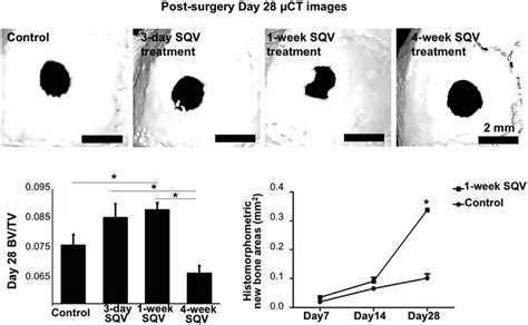 Micro Computed Tomographic And Histologic Analyses Of Skull Bone