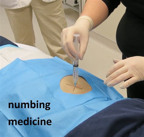 Jms Adventure With Multiple Myeloma Bone Marrow Biopsy 5 Warning