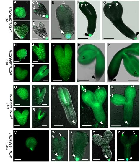 Frontiers Katanin 1 Is Essential For Embryogenesis And Seed Formation