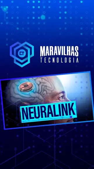 Depois De Muitas Idas E Vindas O Plano Da Startup Neuralink De