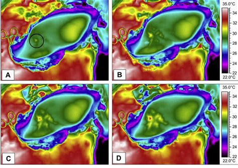 Figure From Dynamic Infrared Thermography Semantic Scholar