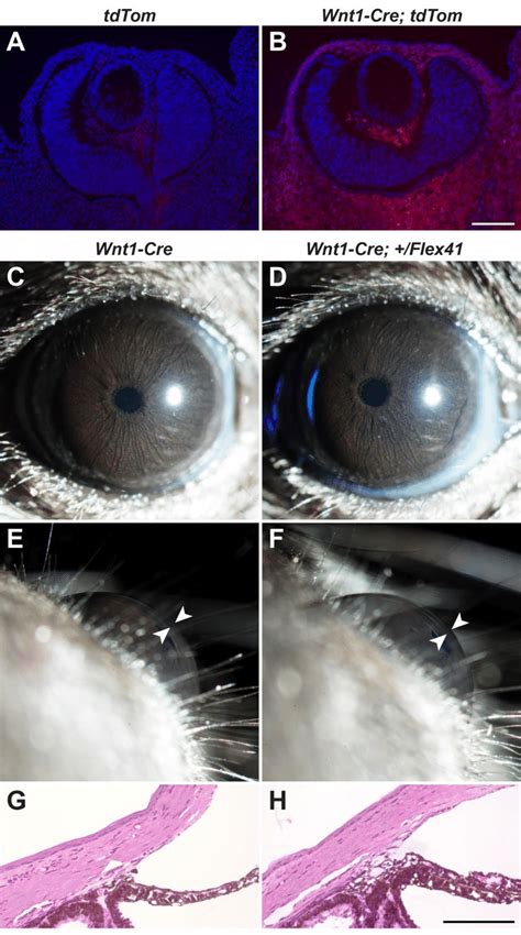 Selective Expression Of Mutant COL4A1 In Neural Crest Derived