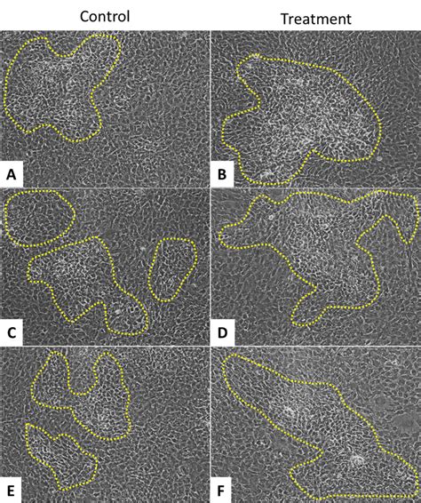 Photomicrographs Of Representative Primary Osteoblast Culture Showing