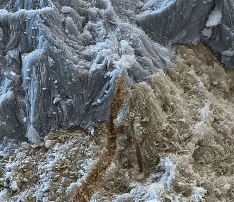 Tooth Sem Stock Image C Science Photo Library