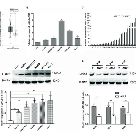 LLGL2 Was Highly Expressed In HCC Tissues And Cells A LLGL2 MRNA