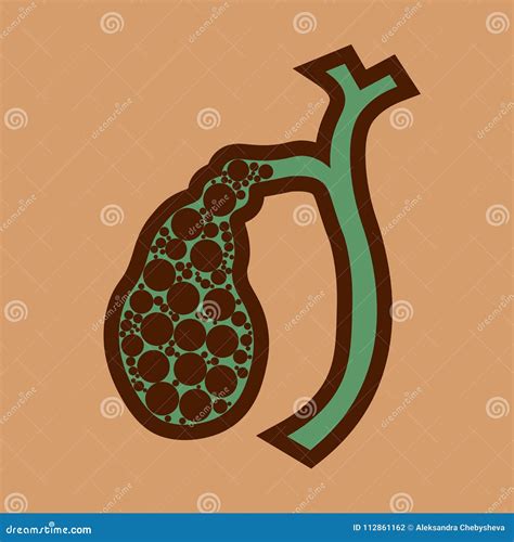 Gallstones Illustration Showing Front View Of Liver And Gallbladder