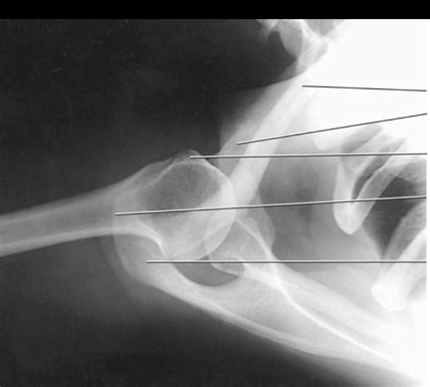 Superinferoir Axial Shoulder Joint Diagram Quizlet
