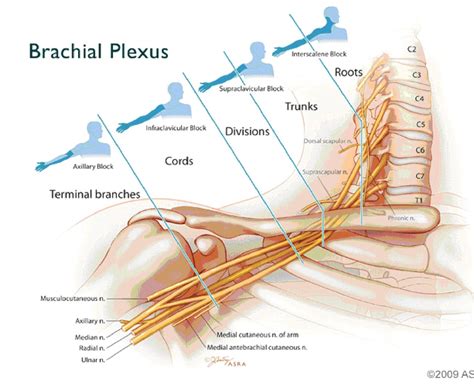 Anterior And Lateral Division Of The Brachial Plexus Google Search