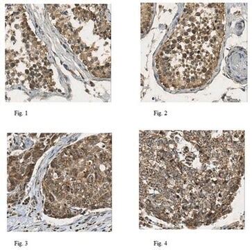 Anti DHODH Antibody From Rabbit Purified By Affinity Chromatography