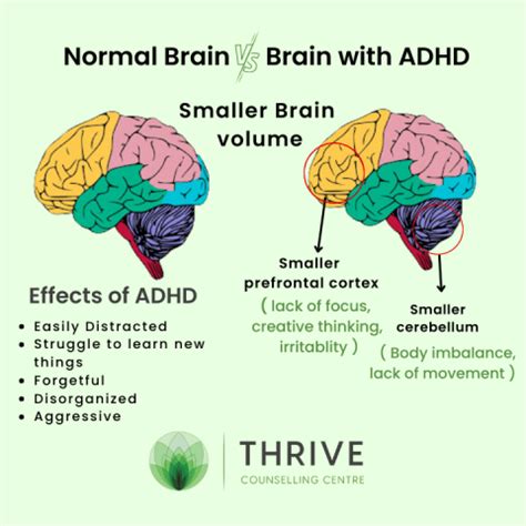 Attention Deficit Hyperactivity Disorder ADHD Sign And Symptoms