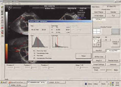 Evaluation Of The Ovarian Vascularity By Three Dimensional Power