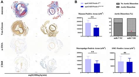 Myeloid Specific Knockout Of Notch Inhibits Myd And Trif Mediated