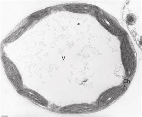 Vacuole Electron Micrograph