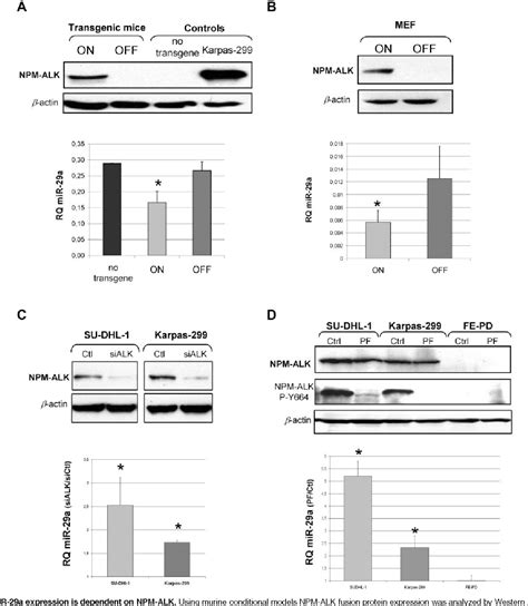 Figure 2 From MiR 29a Down Regulation In ALK Positive Anaplastic Large