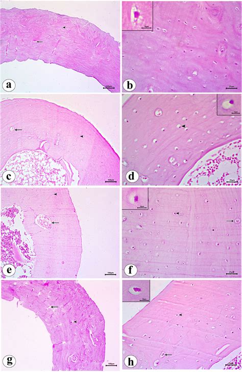 A Photomicrograph Of An H E Stained Section In The Decalcified Femur Of