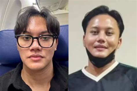 Tak Hanya Mahalini Rizky Febian Dikabarkan Juga Jalani Operasi Plastik