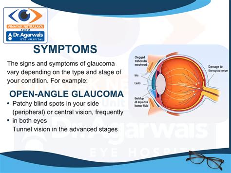 Glaucoma Glaucoma Surgery Glaucoma Eye Surgery Centre Glaucoma