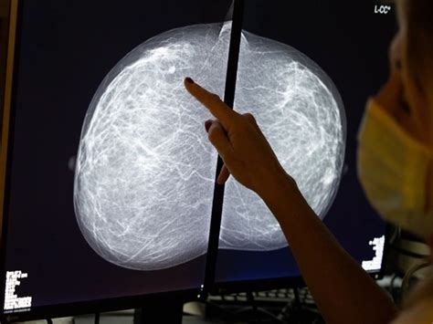 Artificial Intelligence Can Detect Breast Cancer Signs That Doctors