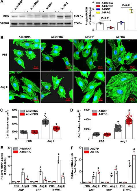 Detrimental Role Of Pdz Rhogef In Pathological Cardiac Hypertrophy