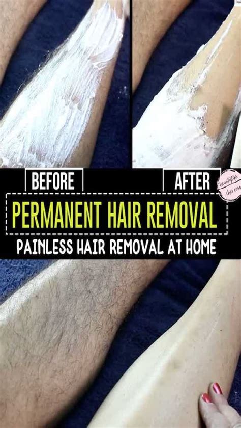 hair removal at home remedies: Permanent Hair Removal At Home!