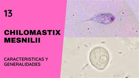 Chilomastix Mesnilii Parasitosis Flagelados Youtube