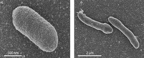 Scientists Engineer New Life Form With Mixed Bacteria And Archaea Membrane